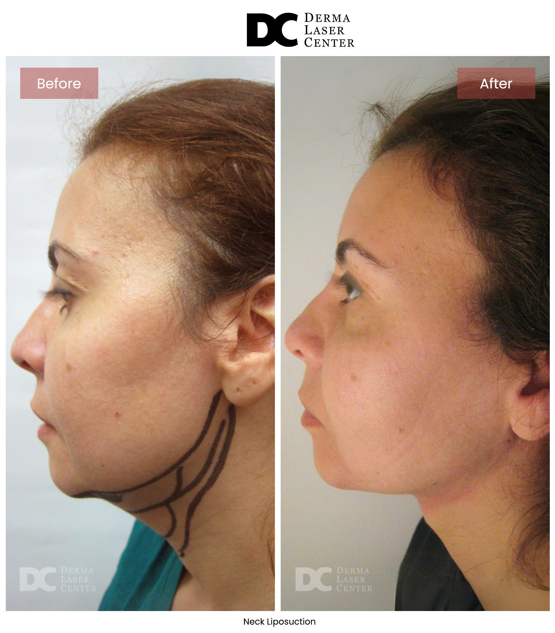 B&A Neck Image 02 V1