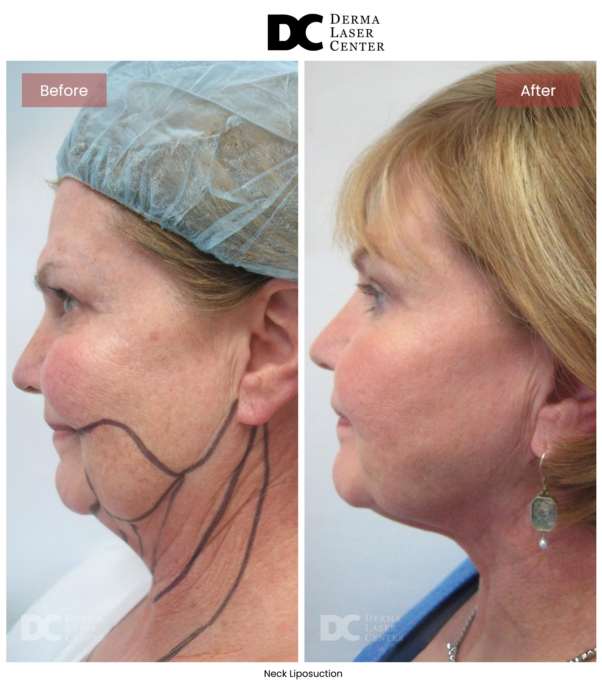 B&A Neck Image 03 V1