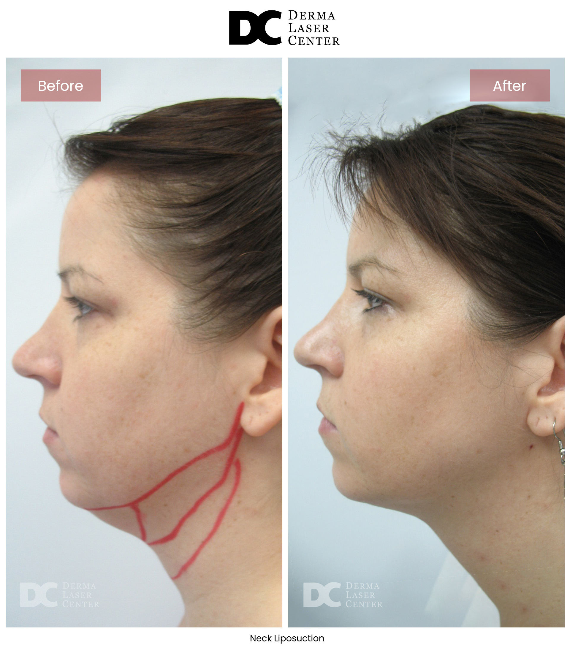 B&A Neck Image 04 V1