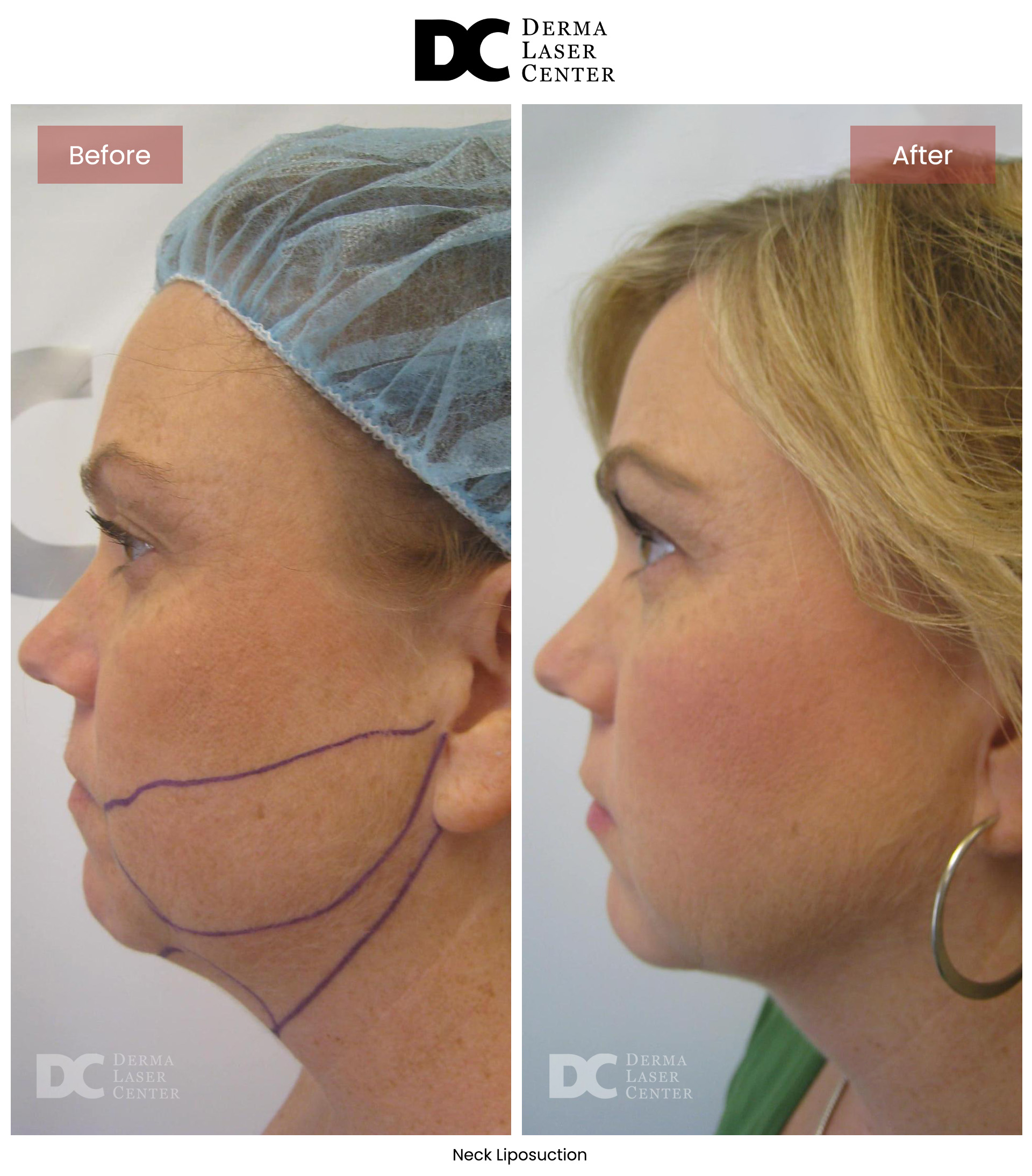 B&A Neck Image 05 V1