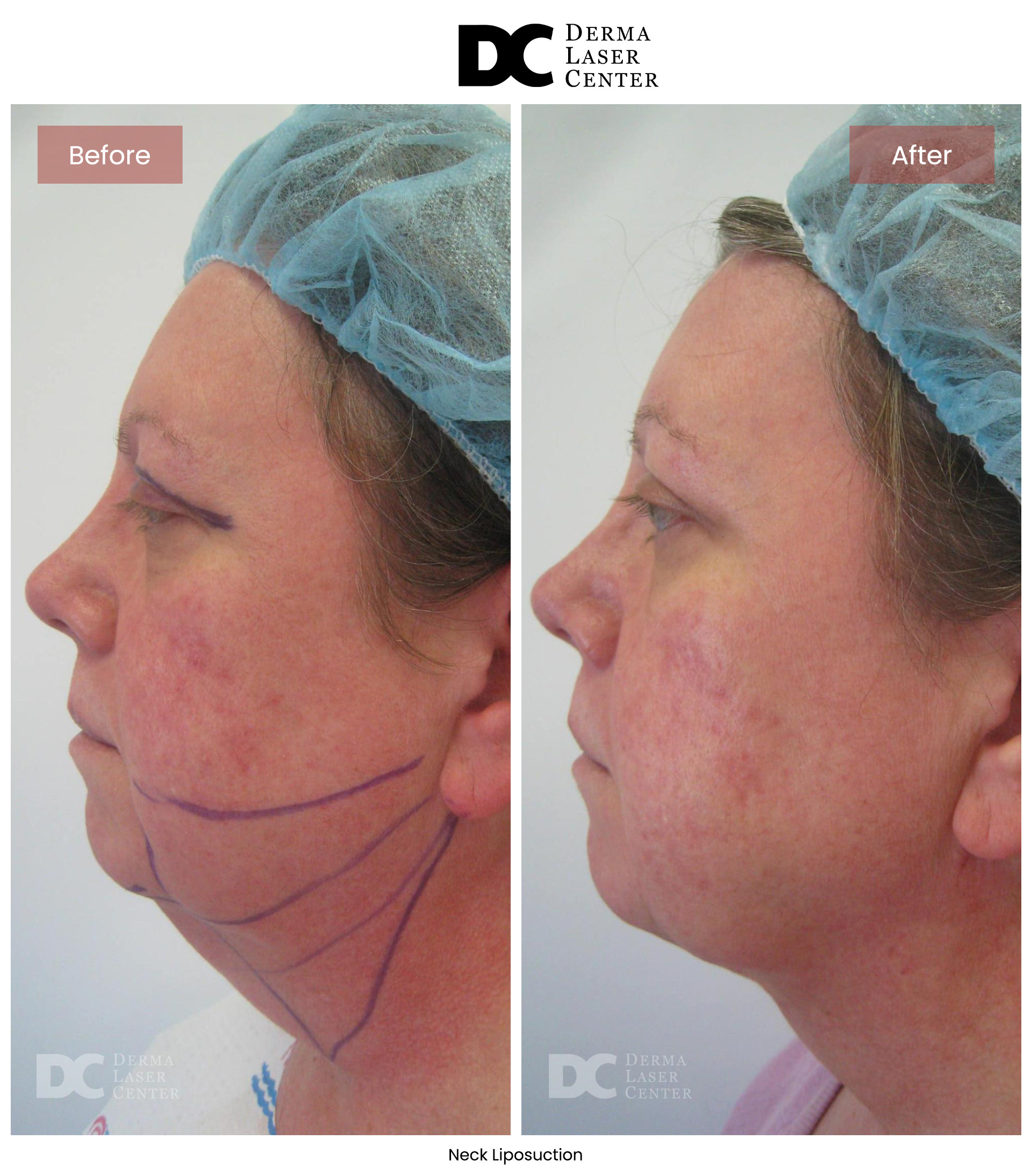 B&A Neck Image 06 V1