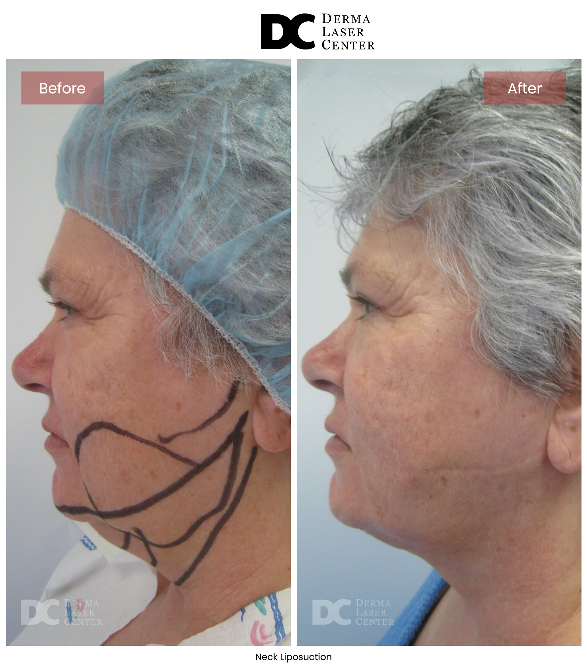 B&A Neck Image 07 V1
