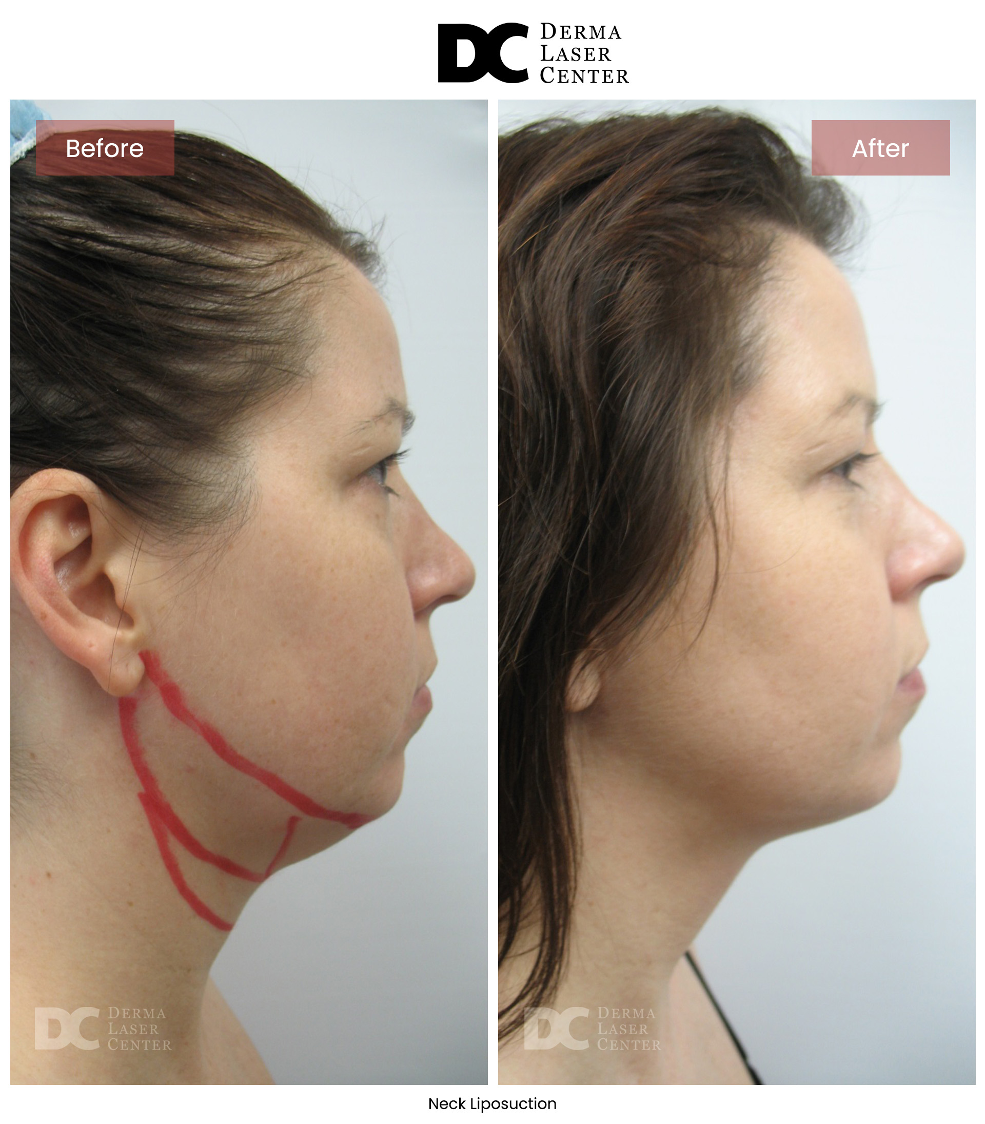 B&A Neck Image 08 V1