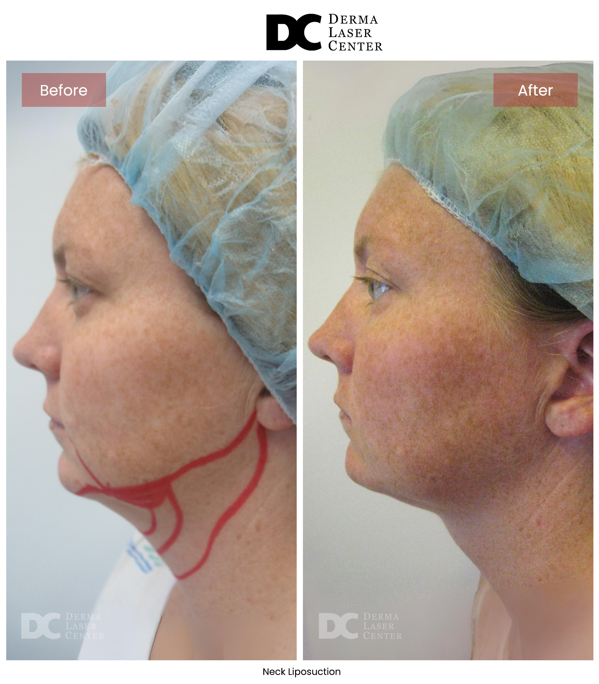 B&A Neck Image 09 V1