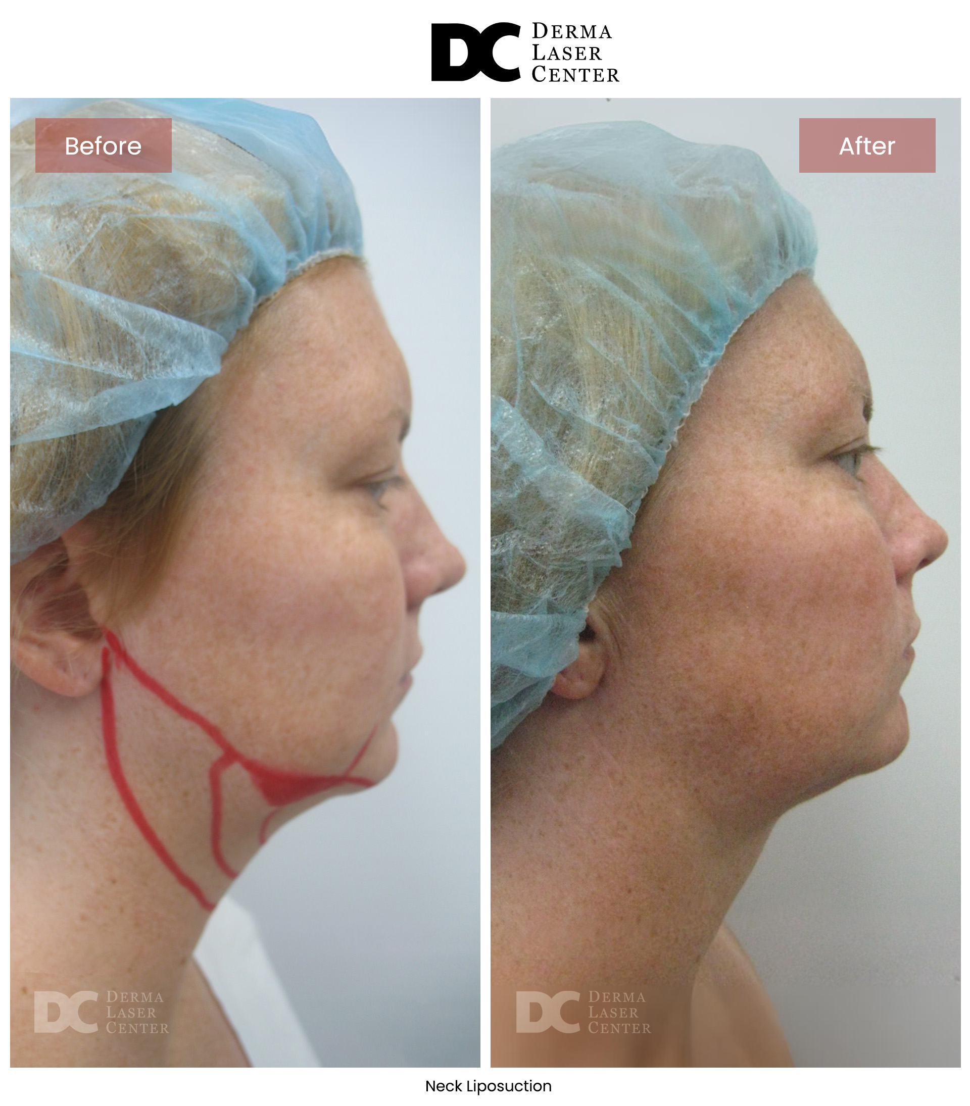 B&A Neck Image 10 V1