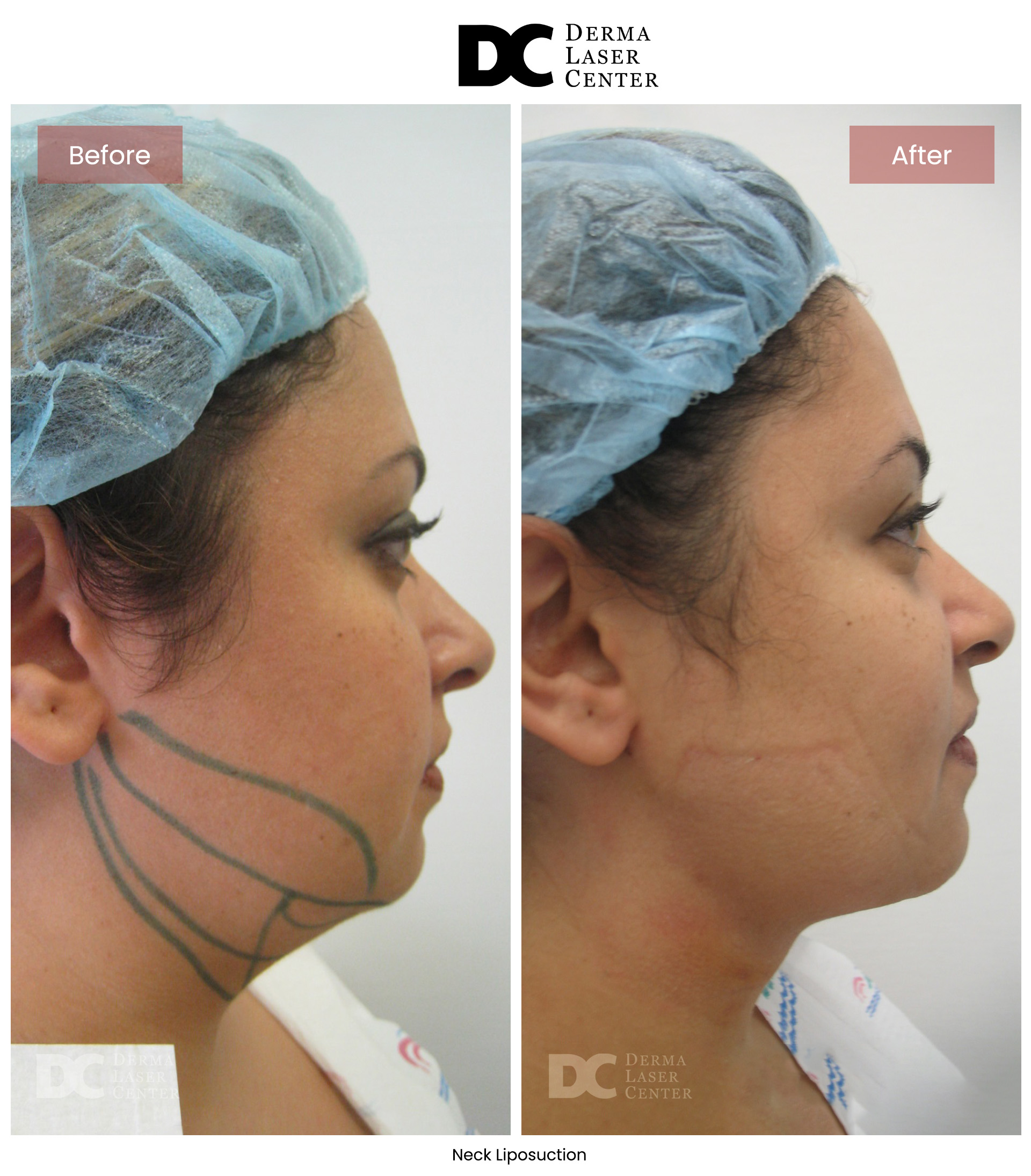B&A Neck Image 11 V1