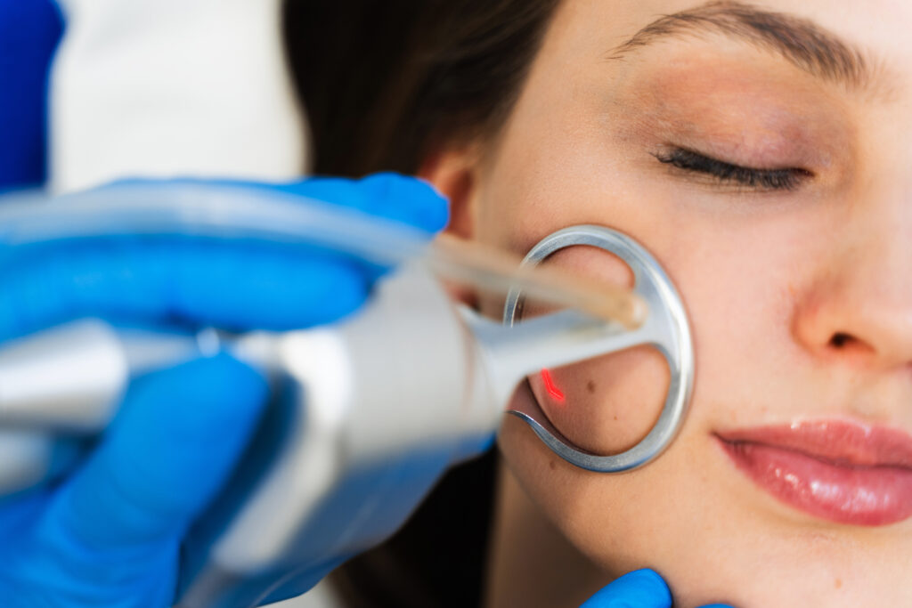 Process of facial CO2 laser resurfacing. Cosmetologist removes wrinkles and scars using laser from face of attractive girl.