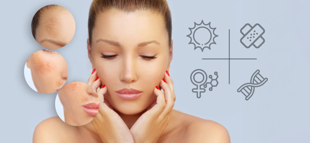 What Causes Hyperpigmentation