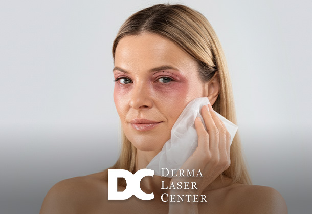 Blepharoplasty Recovery Timeline