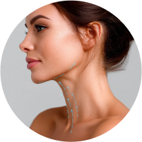 Double Chin Lipo Pictures