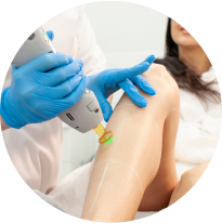 Laser Hair Removal Photos