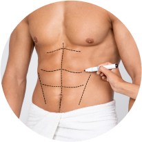 Male Lipo Pictures