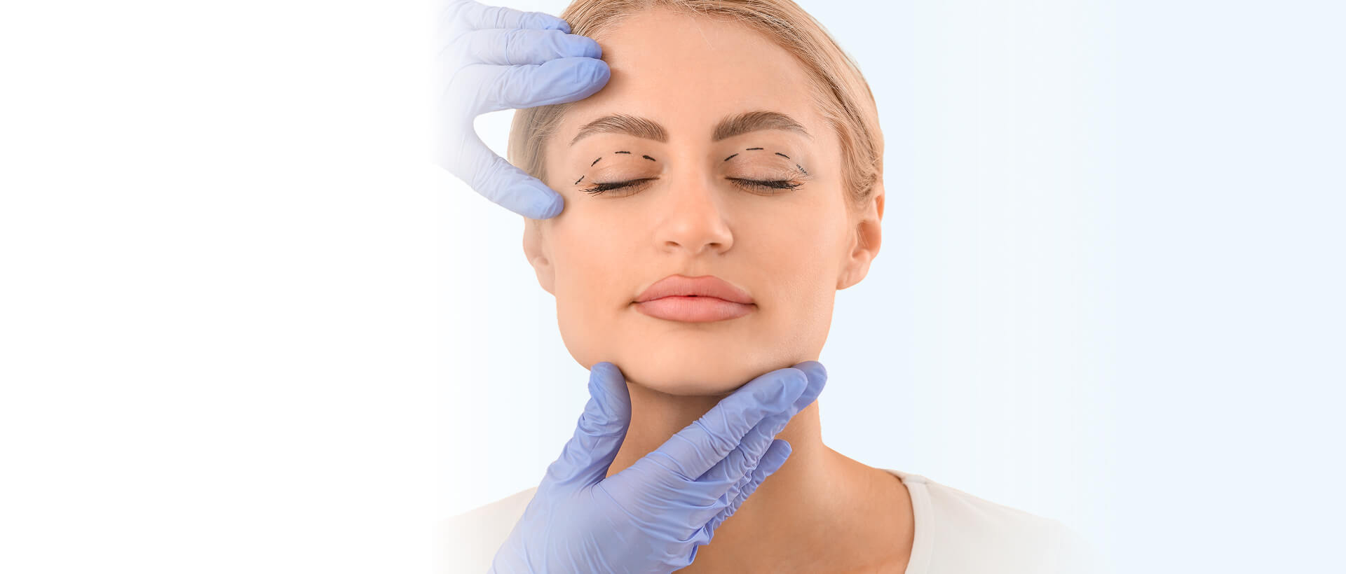 Upper Blepharoplasty Cost NJ