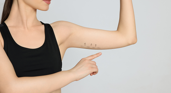 Arm Liposuction
