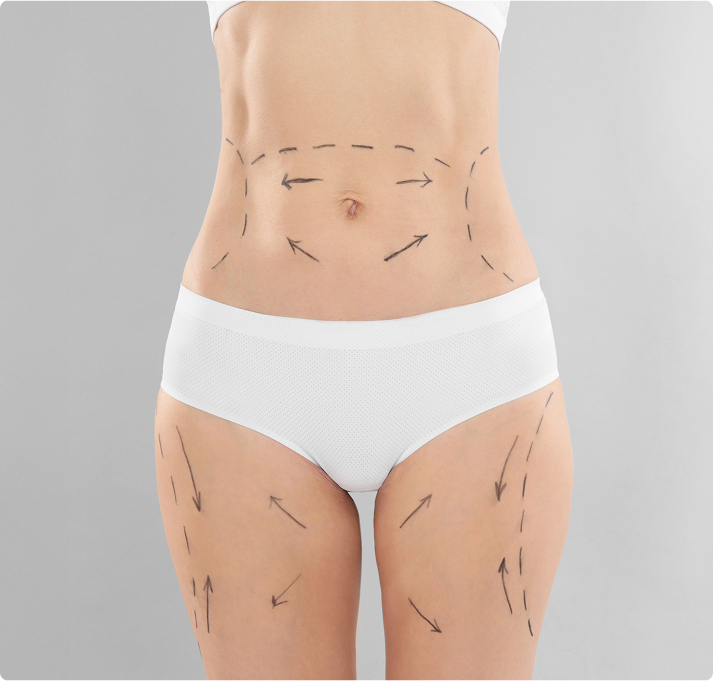 Liposuction NJ cost