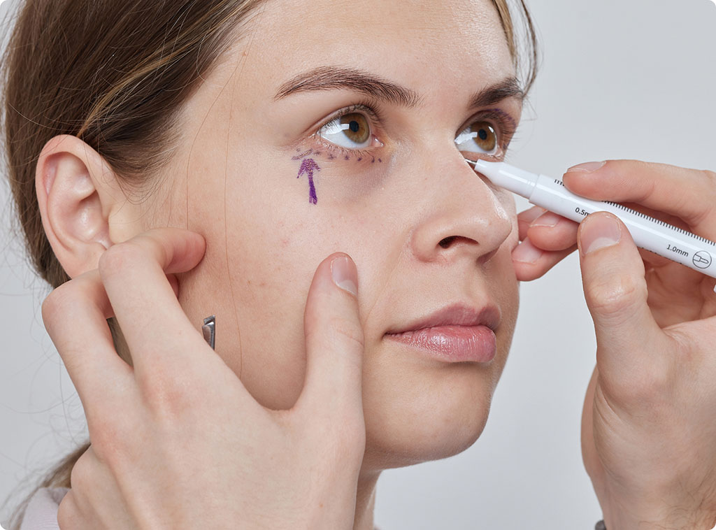 lower blepharoplasty cost New Jersey