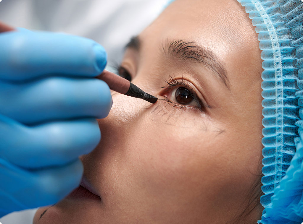 upper and lower lid blepharoplasty cost