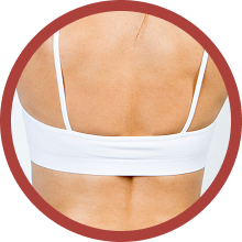 Upper Back (Bra Line Area)