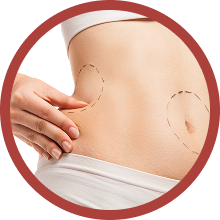 Waist : Flanks (“Love Handles”)