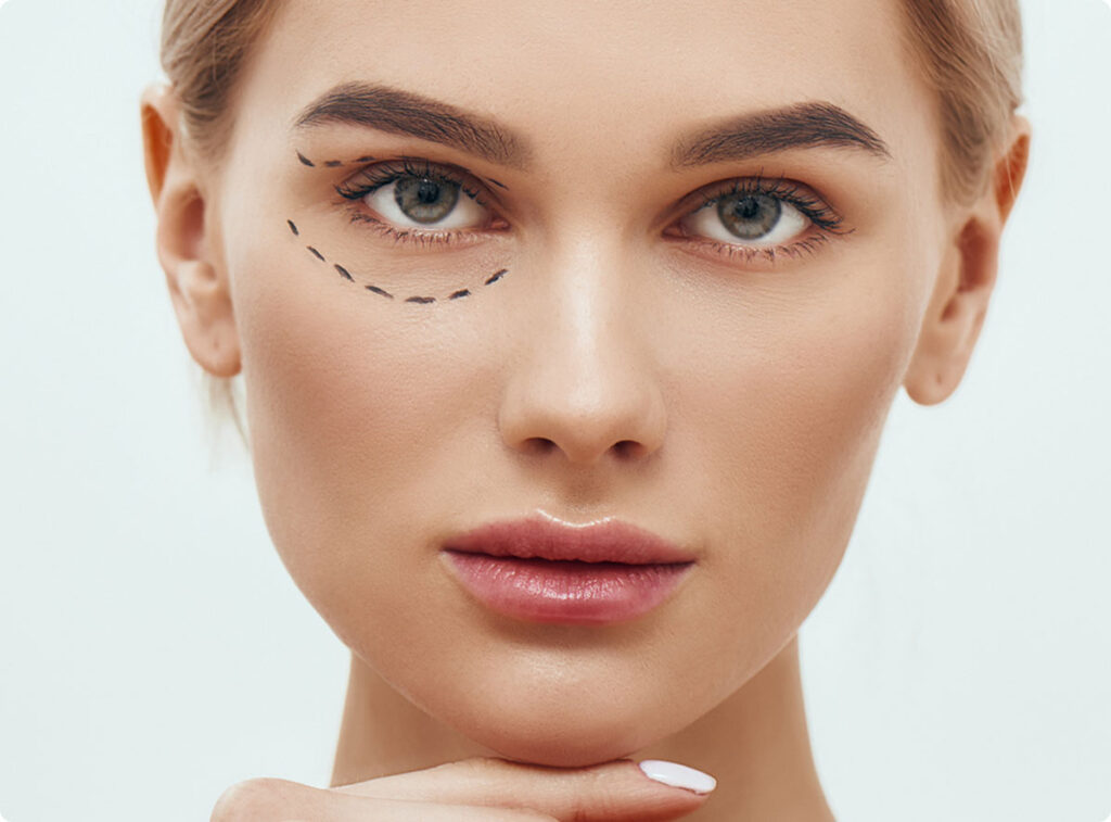 blepharoplasty surgeon