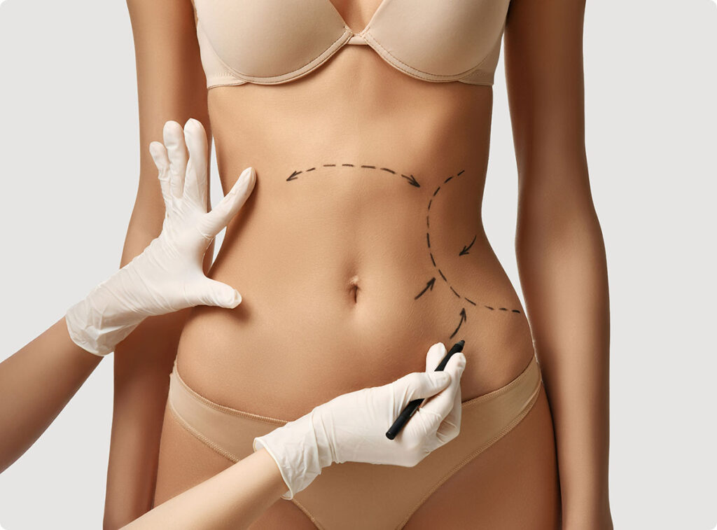 liposuction surgery and non surgical procedures