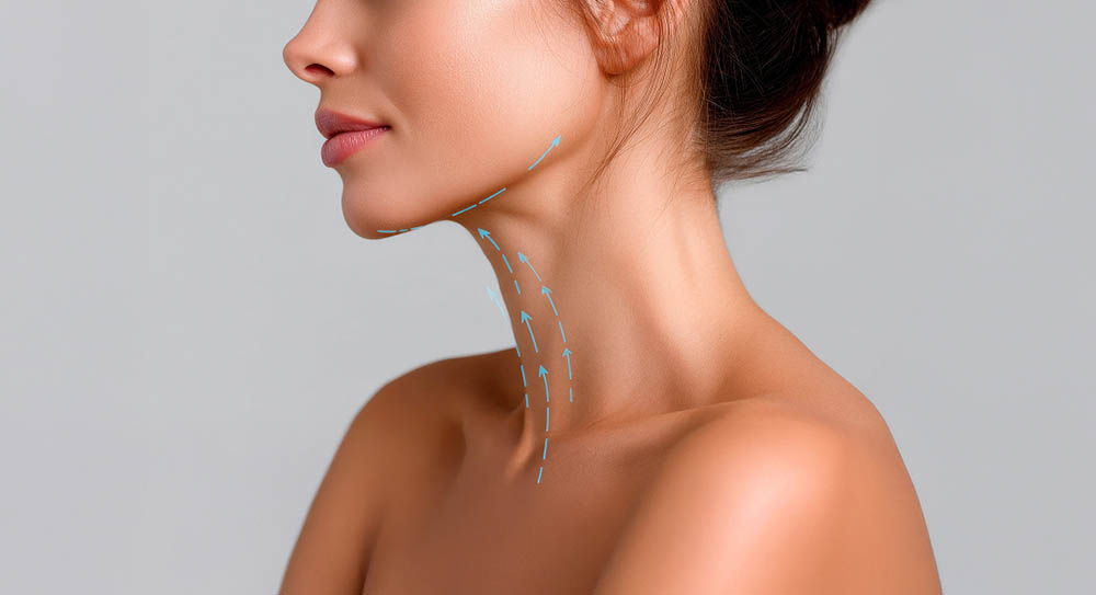 Double Chin Lipo Pictures