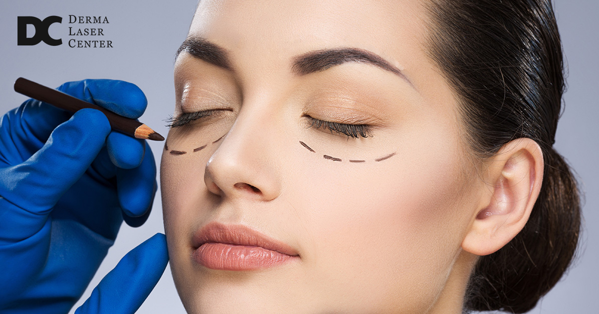 Blepharoplasty Recovery Tips