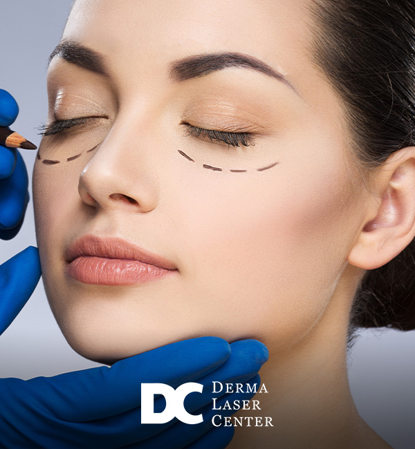 Blepharoplasty Recovery Tips