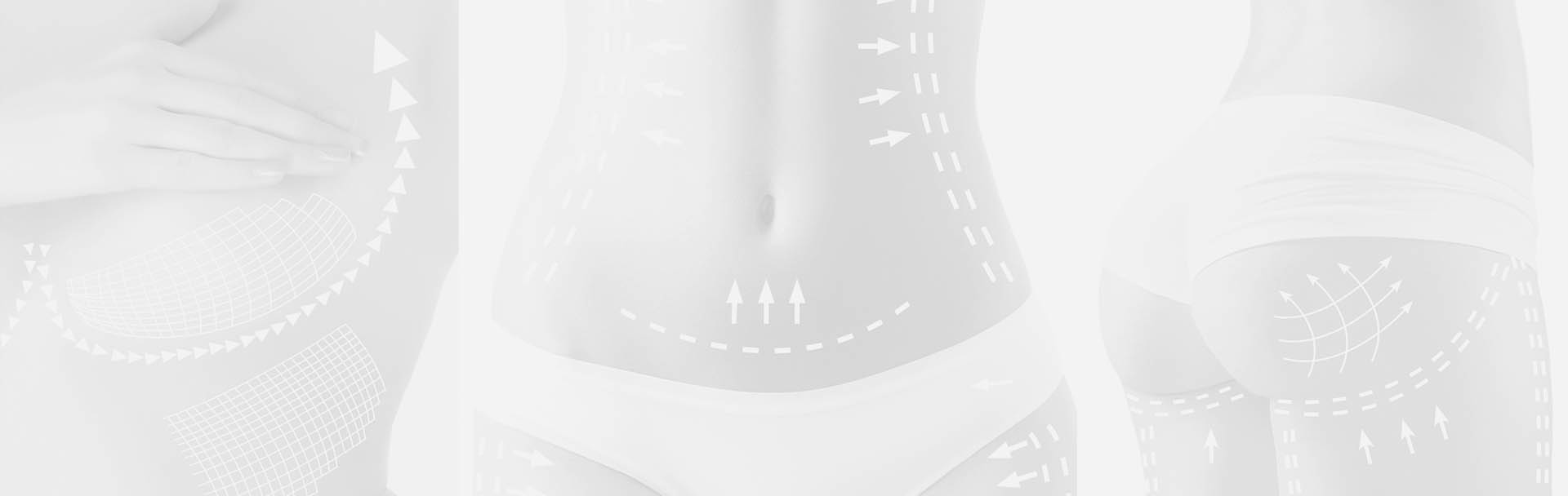 insurance schedule a consultation