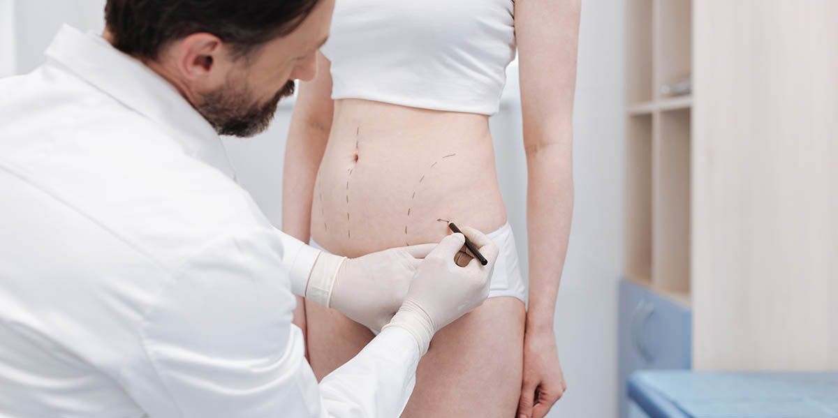What Is Considered a Safe Amount of Liposuction Weight Loss