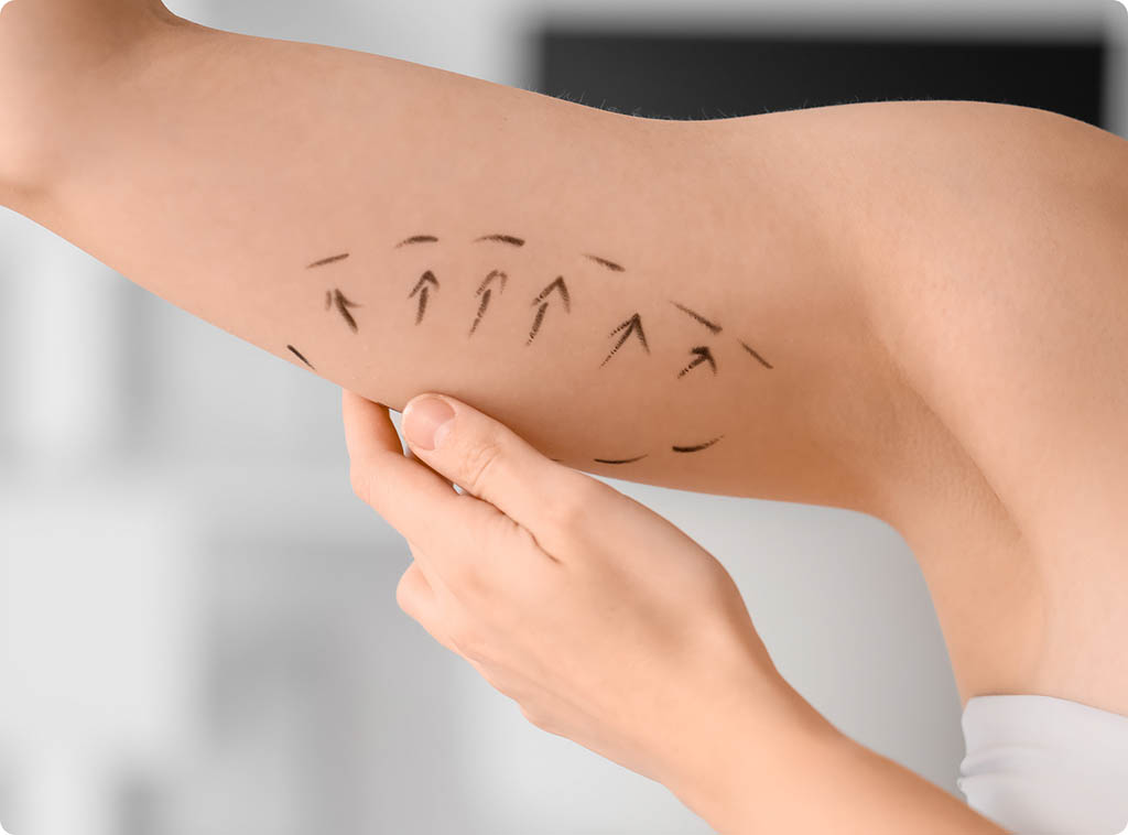 Arm liposuction cost New Jersey