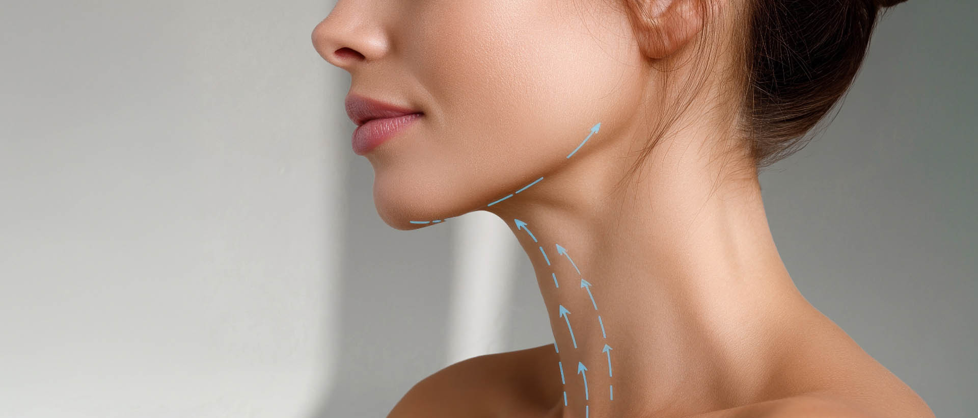 Double Chin Lipo New Jersey