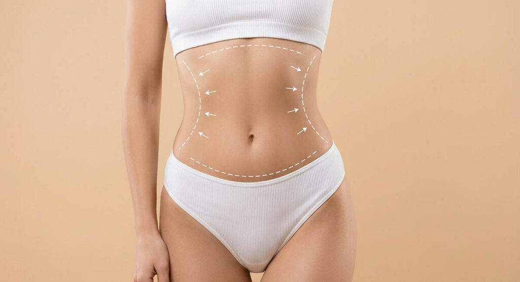 How Much Does Laser Liposuction Cost in New Jersey?