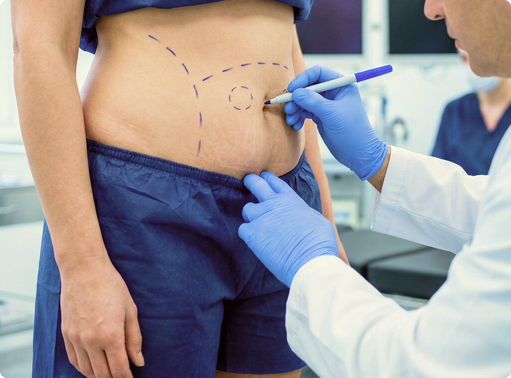 liposuction surgery in NJ
