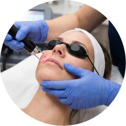 Facial Laser Hair Removal