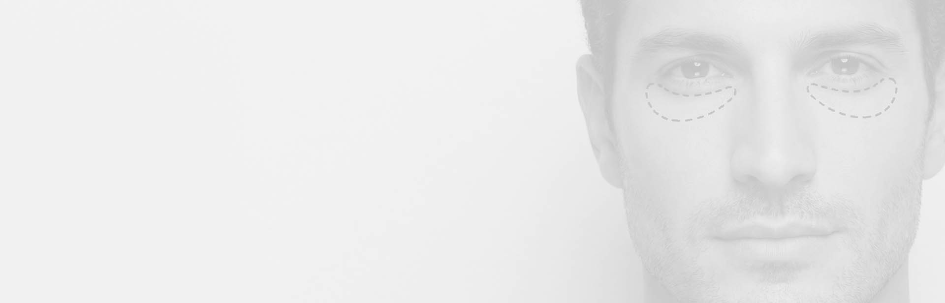 Limited Time Offer — $500 Off Blepharoplasty