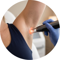 Underarm & Arm Treatments