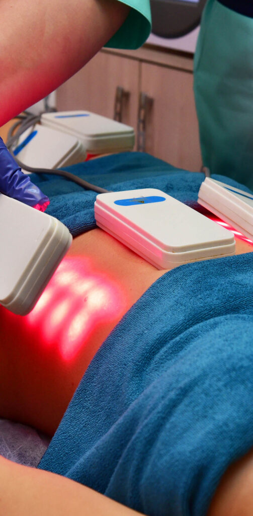 laser lipo New Jersey