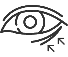Lower Blepharoplasty