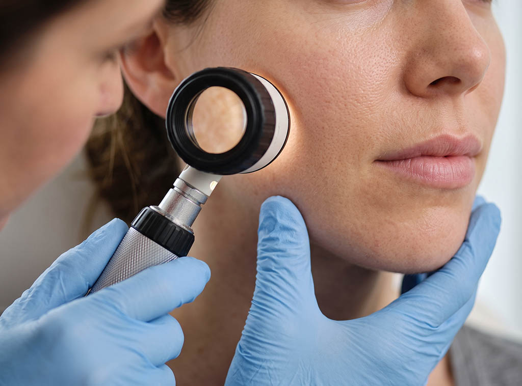 CO2 laser treatment New Jersey
