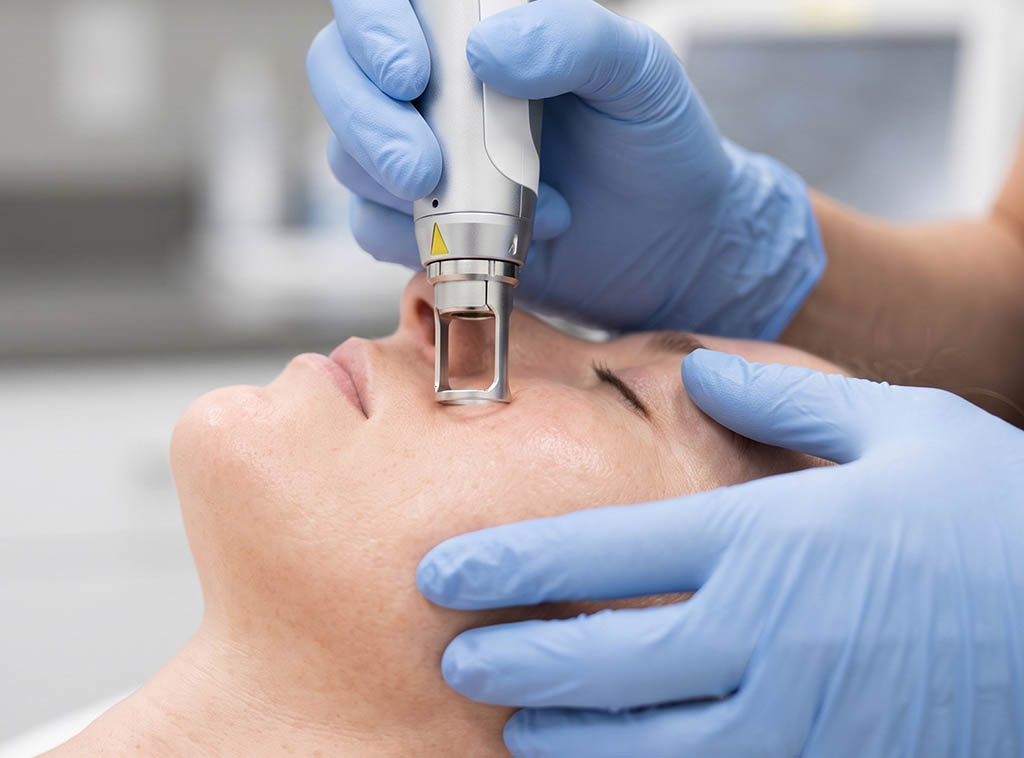 laser skin resurfacing NJ