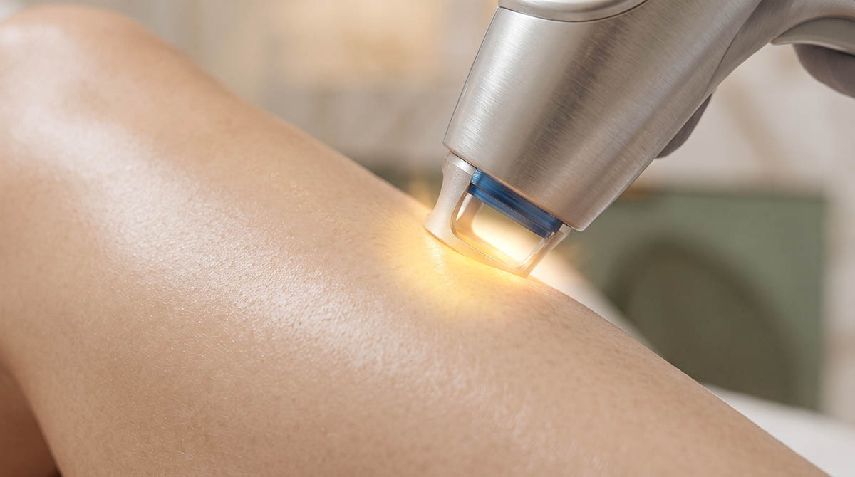 What does laser hair removal actually feel like?