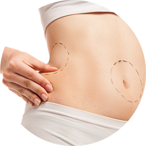 Waist : Flanks (“Love Handles”)
